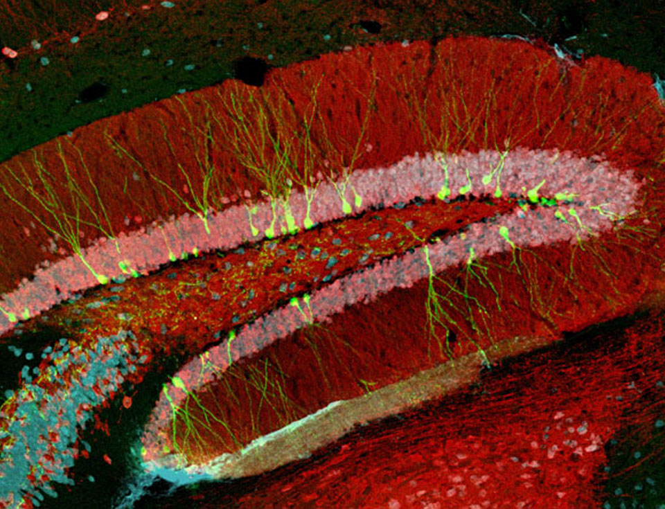 Imagen obtenida por microscopía confocal, correspondiente a un corte de hipocampo obtenido de ratones adultos. En verde fluorescente pueden observarse neuronas granulares inmaduras (21 días de edad) generadas en el cerebro adulto. Para marcar y visualizar las neuronas nuevas, los investigadores emplean un retrovirus como herramienta para insertar en el genoma de las células en división (neuronas nuevas) el gen de la proteína verde fluorescente (GFP).
