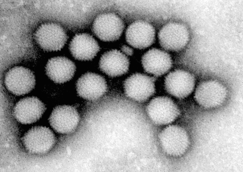 Virus oncolíticos para eliminar tumores diseñados con la colaboración de Verónica López, Eduardo Cafferata y Diego Viale en el laboratorio del doctor Podhajcer en el Instituto Leloir.