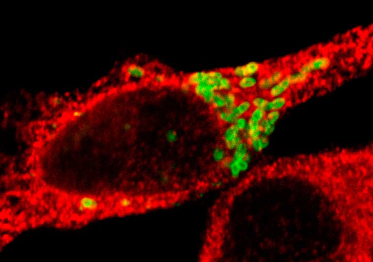 Imagen microscópica de la bacteria de la brucelosis (color verde) reproduciéndose en el interior de un glóbulo blanco de ratón (color rojo). El estudio liderado en el Instituto Leloir sienta bases para el desarrollo futuro de terapias eficaces.