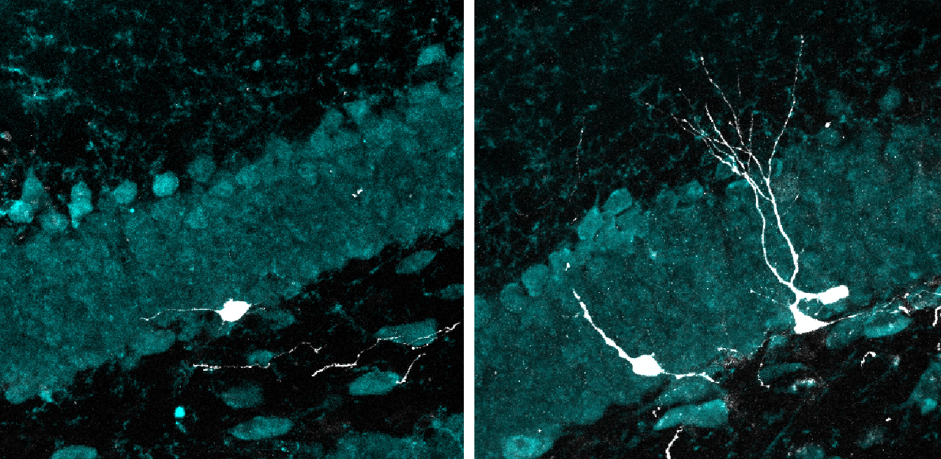 La estimulación con luz y sonido intermitentes promueve el desarrollo de nuevas neuronas en cerebros envejecidos
