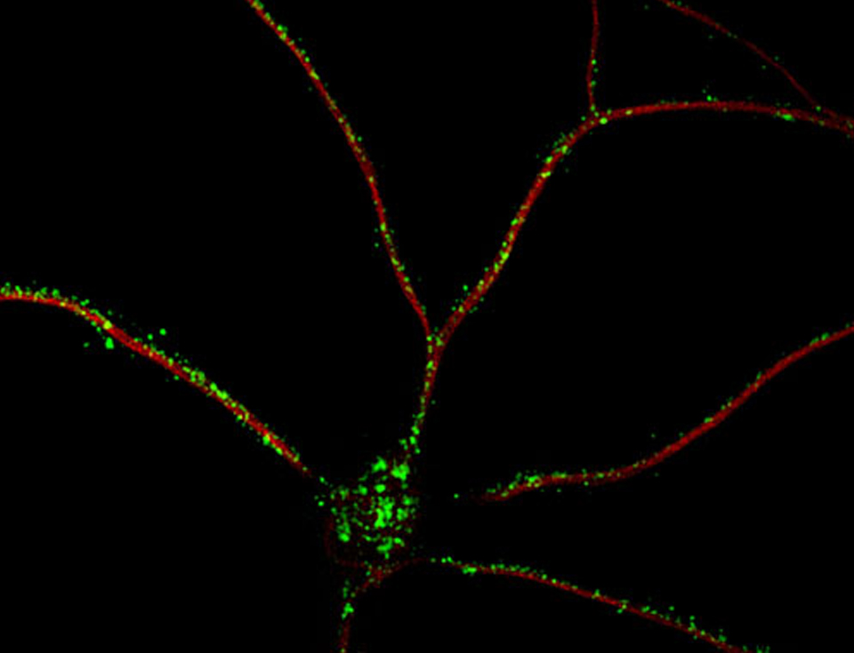 Neurona con focos de Smaug1, una estructura clave para las sinapsis. Fue descubierta por los investigadores del Instituto Leloir.