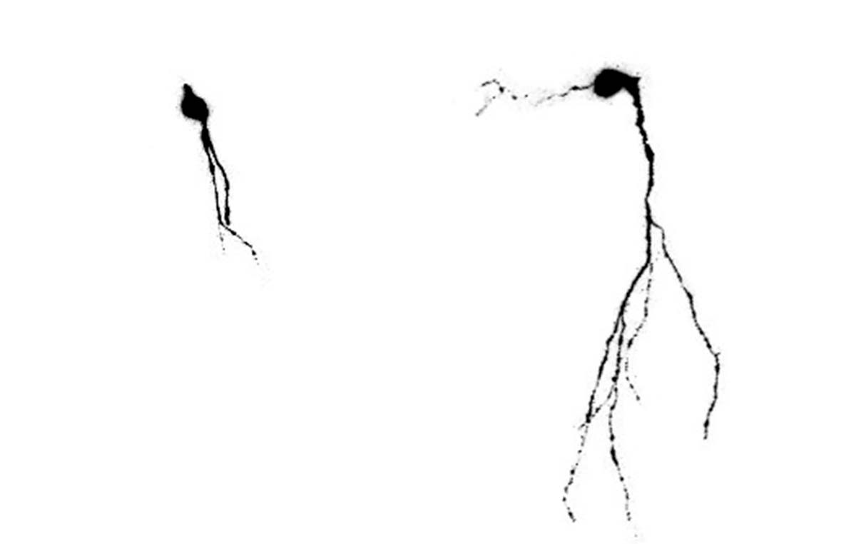 Animales envejecidos sedentarios presentan neuronas con cables muy cortos (izquierda), mientras que si realizaron ejercicio o tuvieron estímulos cognitivos las neuronas están muy desarrolladas y conectadas al circuito cerebral (derecha).